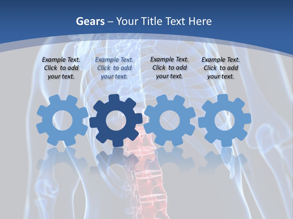 Rheumatism Lumbar Vertebrae PowerPoint Template