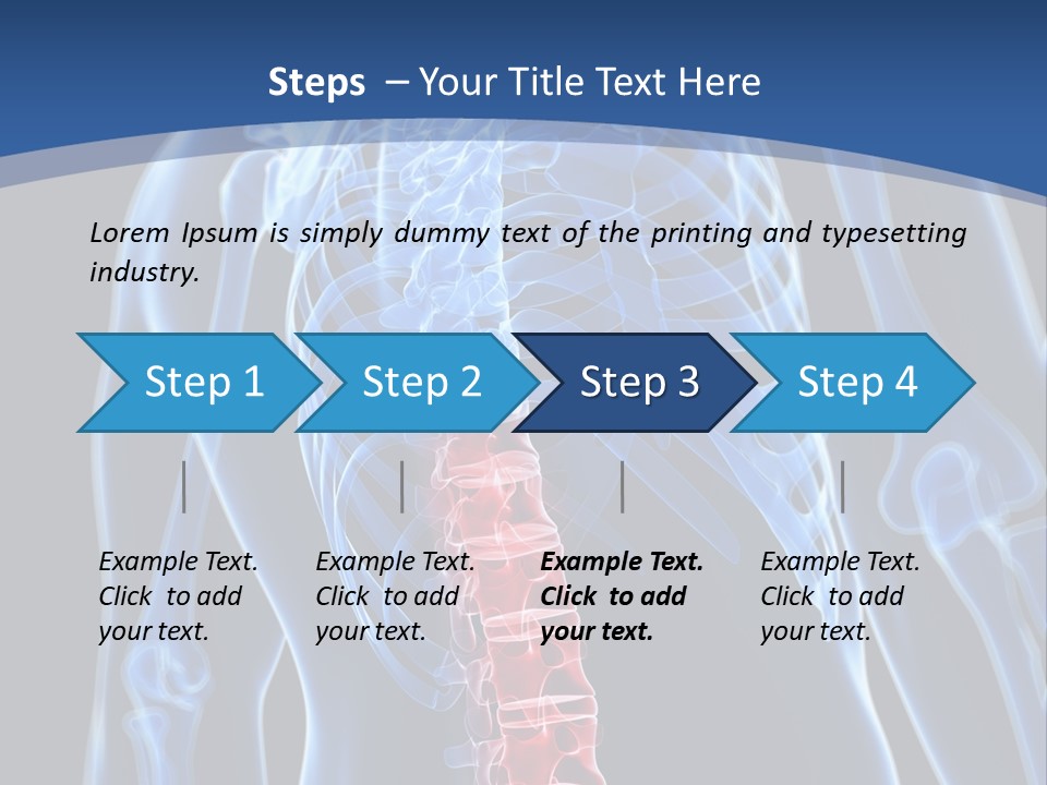 Rheumatism Lumbar Vertebrae PowerPoint Template