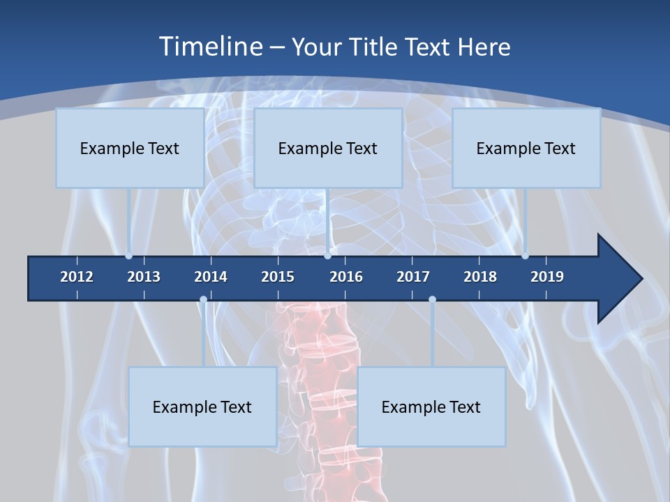 Rheumatism Lumbar Vertebrae PowerPoint Template