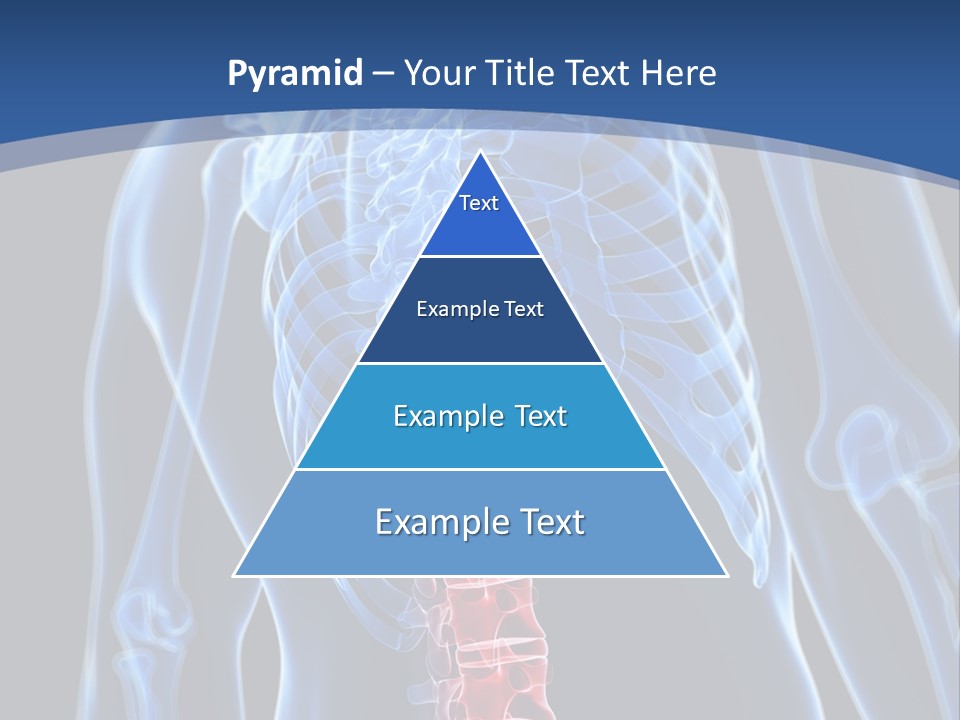 Rheumatism Lumbar Vertebrae PowerPoint Template