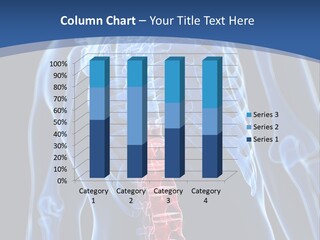 Rheumatism Lumbar Vertebrae PowerPoint Template