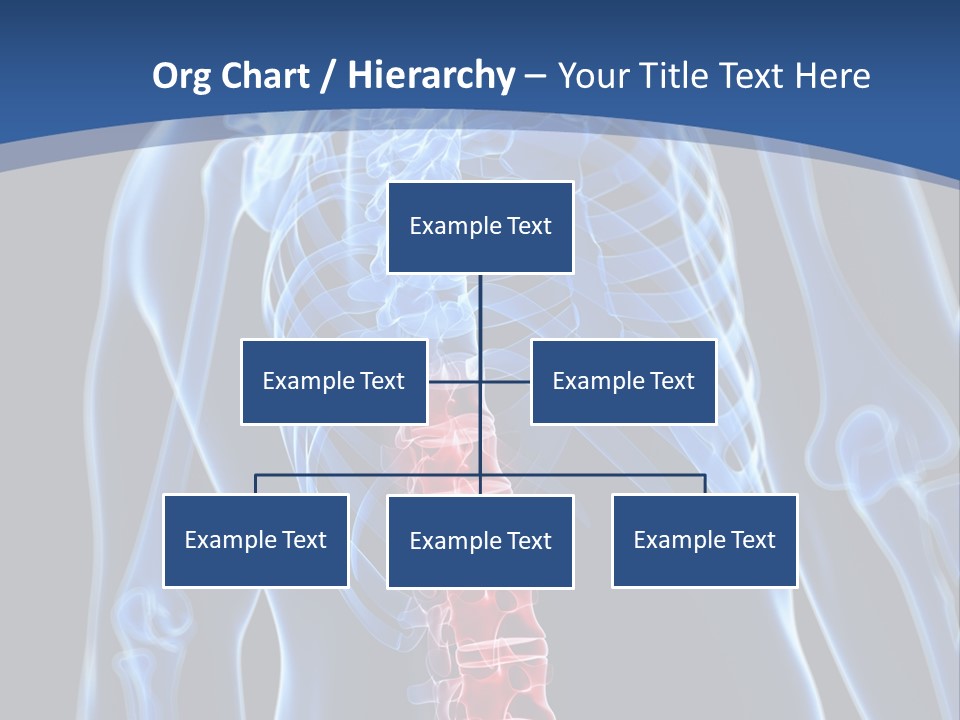Rheumatism Lumbar Vertebrae PowerPoint Template