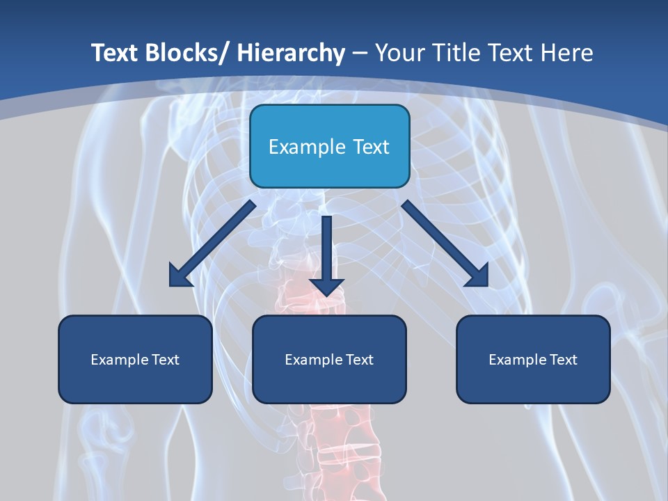 Rheumatism Lumbar Vertebrae PowerPoint Template