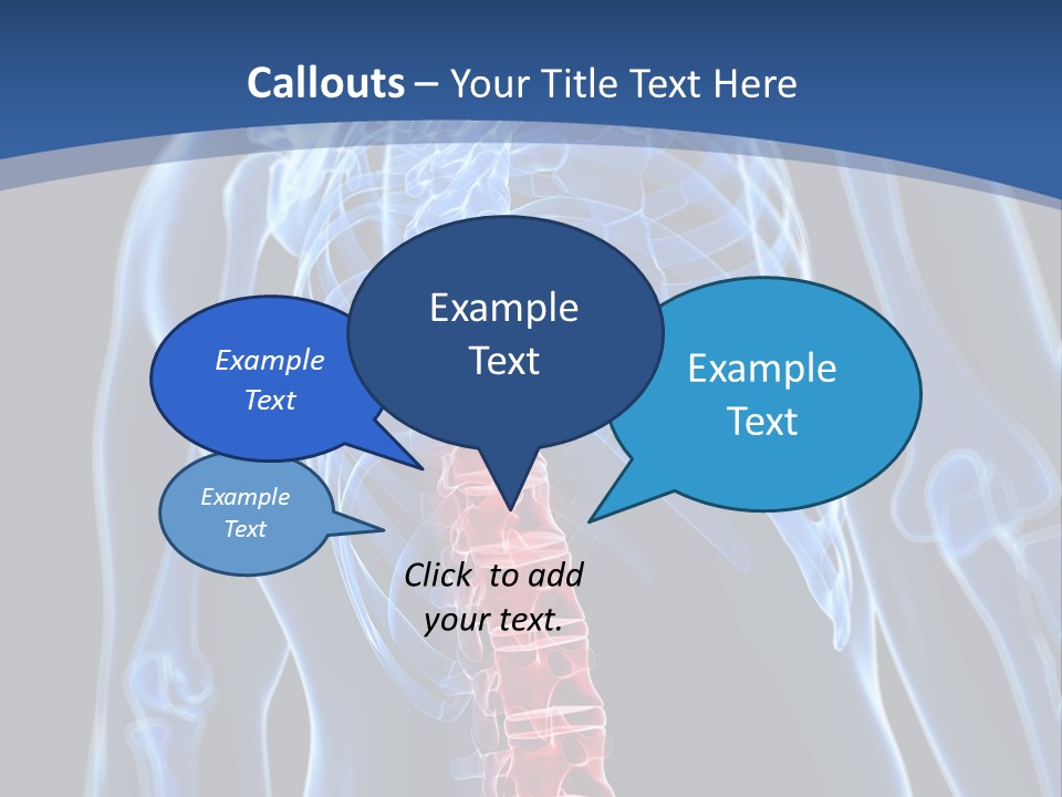 Rheumatism Lumbar Vertebrae PowerPoint Template