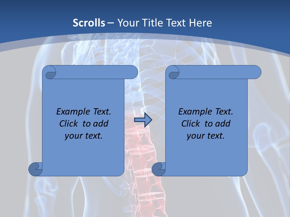 Rheumatism Lumbar Vertebrae PowerPoint Template