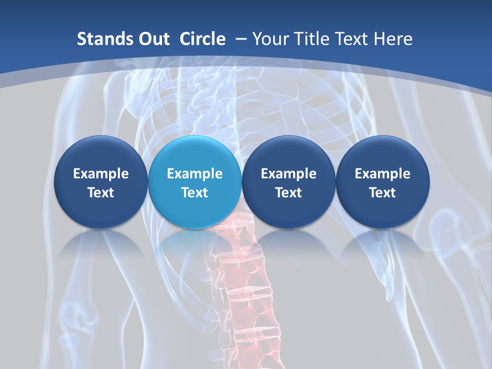 Rheumatism Lumbar Vertebrae PowerPoint Template