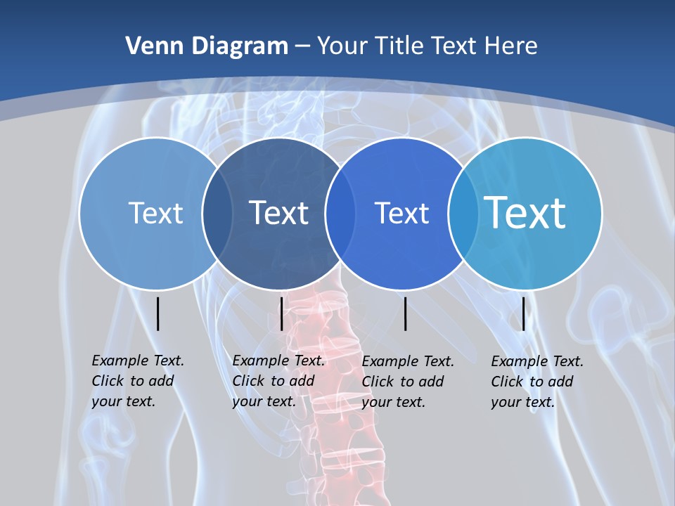 Rheumatism Lumbar Vertebrae PowerPoint Template