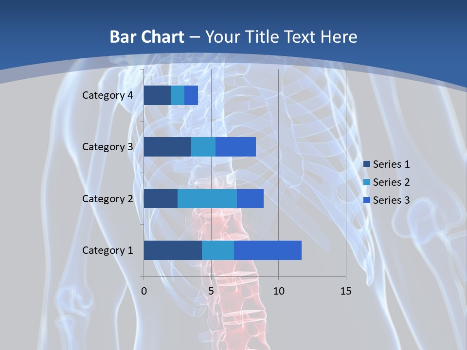 Rheumatism Lumbar Vertebrae PowerPoint Template