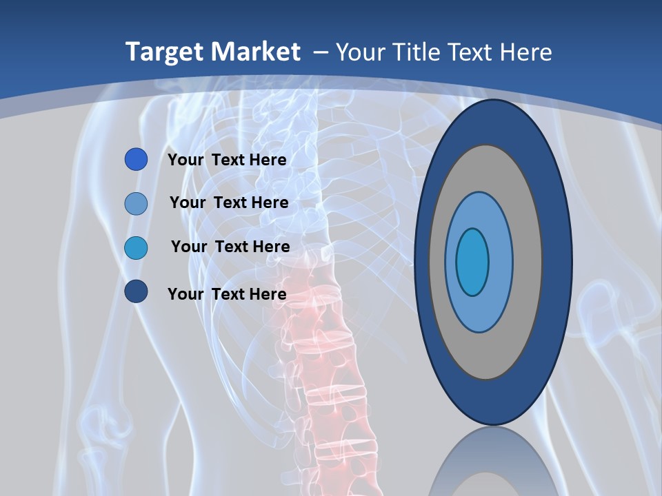 Rheumatism Lumbar Vertebrae PowerPoint Template