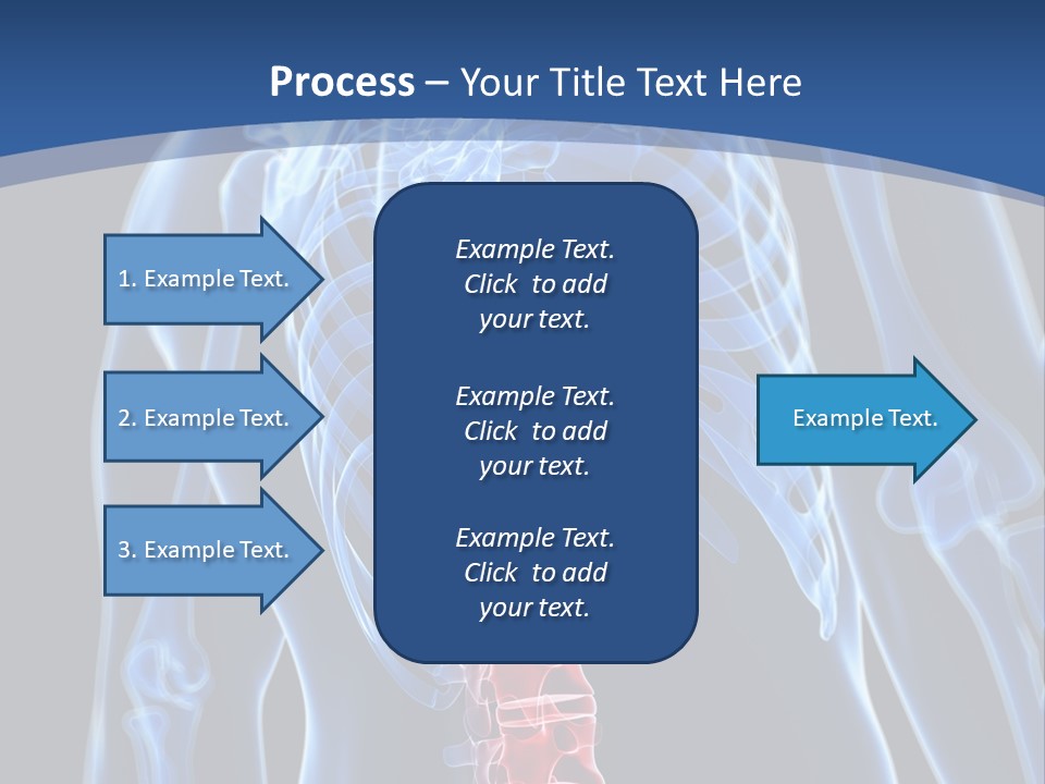 Rheumatism Lumbar Vertebrae PowerPoint Template