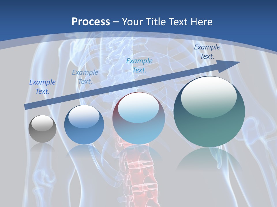 Rheumatism Lumbar Vertebrae PowerPoint Template