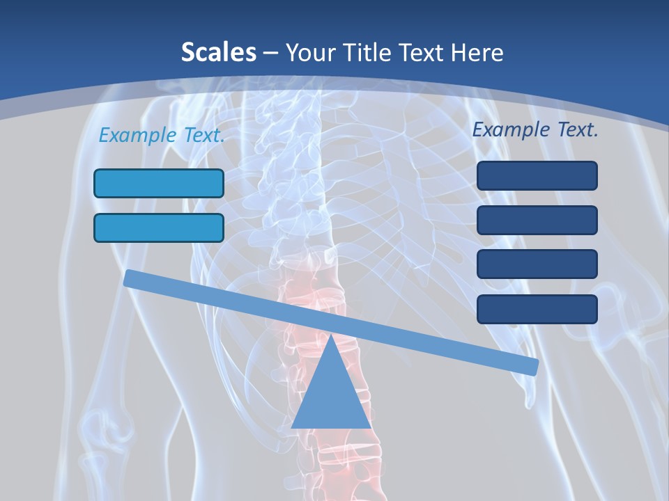 Rheumatism Lumbar Vertebrae PowerPoint Template