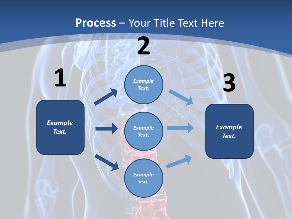 Rheumatism Lumbar Vertebrae PowerPoint Template
