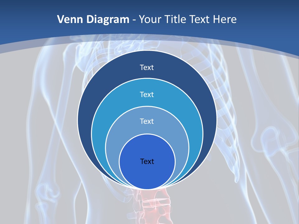 Rheumatism Lumbar Vertebrae PowerPoint Template