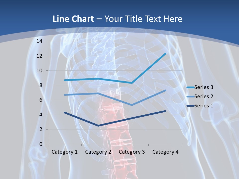 Rheumatism Lumbar Vertebrae PowerPoint Template