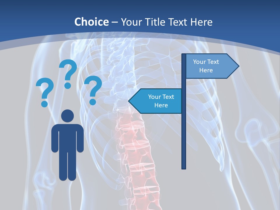 Rheumatism Lumbar Vertebrae PowerPoint Template