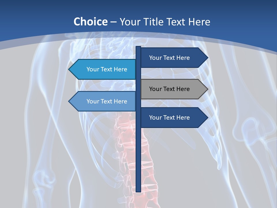 Rheumatism Lumbar Vertebrae PowerPoint Template