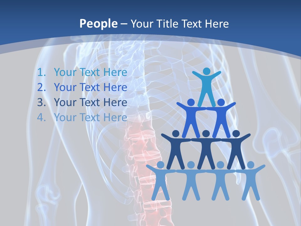 Rheumatism Lumbar Vertebrae PowerPoint Template