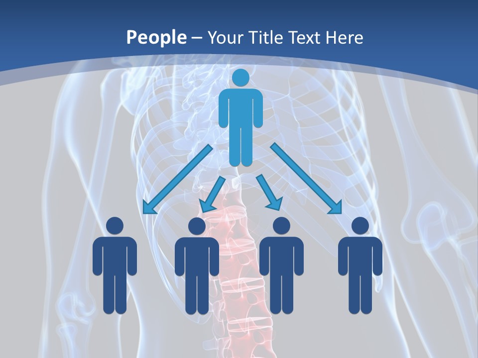 Rheumatism Lumbar Vertebrae PowerPoint Template