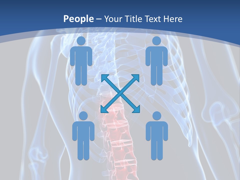Rheumatism Lumbar Vertebrae PowerPoint Template