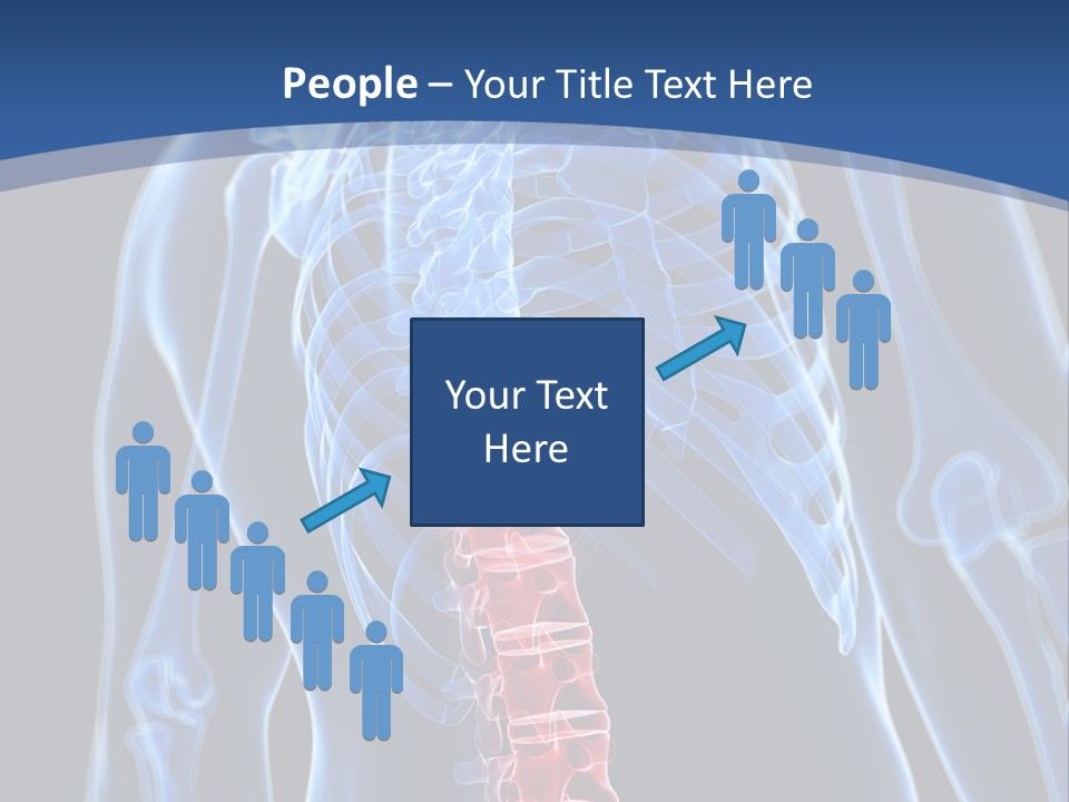 Rheumatism Lumbar Vertebrae PowerPoint Template