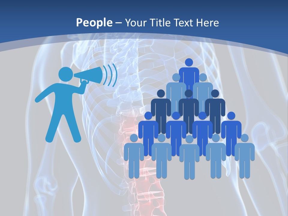 Rheumatism Lumbar Vertebrae PowerPoint Template