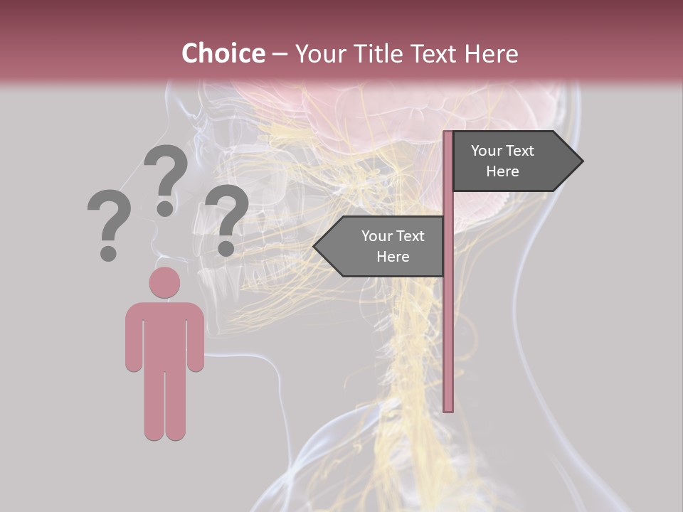 Rebound Head Megrim PowerPoint Template
