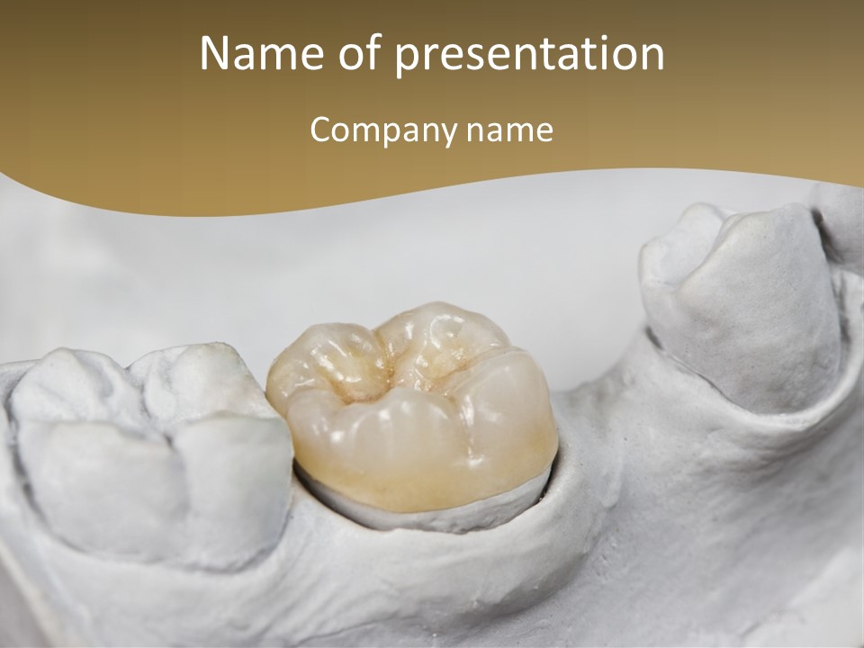 Prosthodontic Gypsum Crown PowerPoint Template