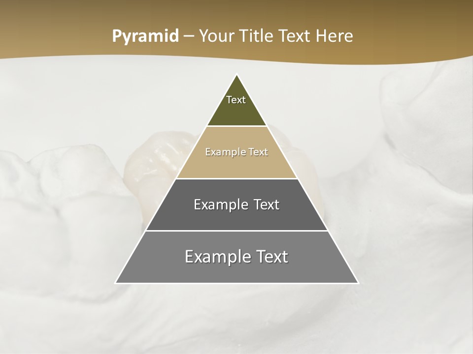Prosthodontic Gypsum Crown PowerPoint Template