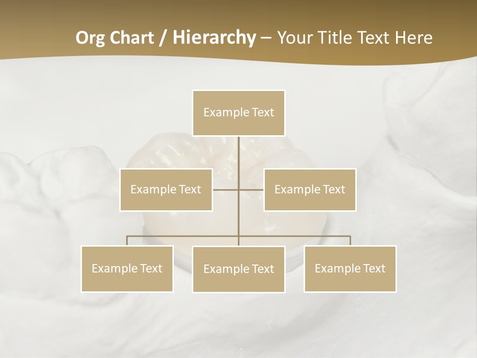 Prosthodontic Gypsum Crown PowerPoint Template