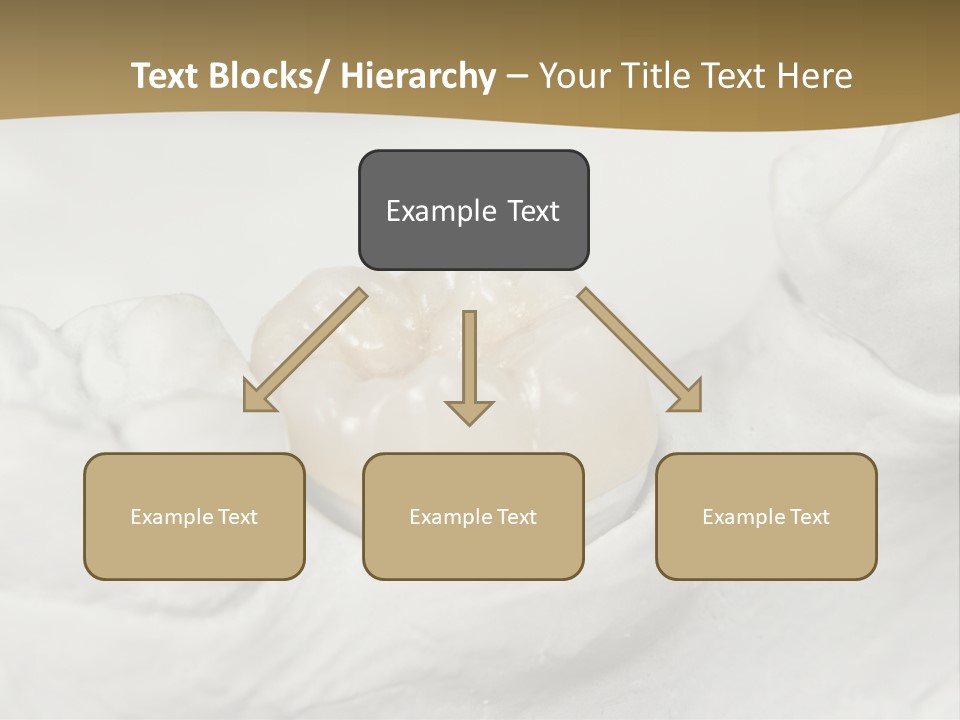 Prosthodontic Gypsum Crown PowerPoint Template