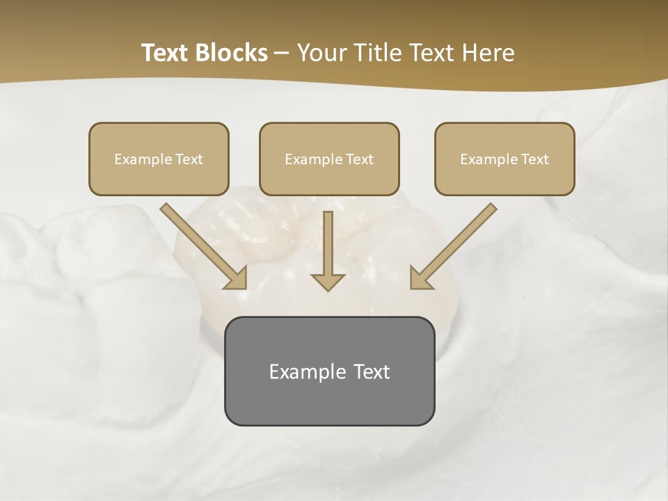 Prosthodontic Gypsum Crown PowerPoint Template
