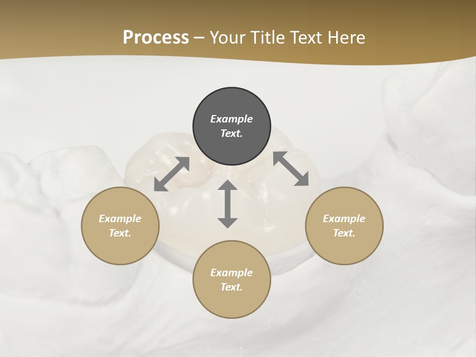 Prosthodontic Gypsum Crown PowerPoint Template