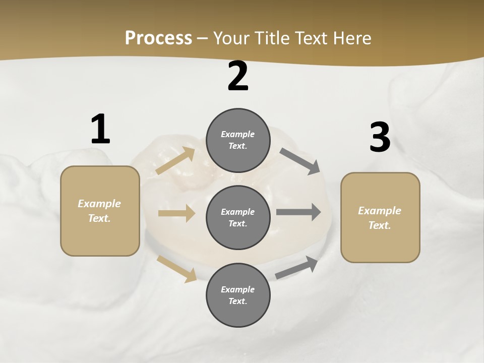 Prosthodontic Gypsum Crown PowerPoint Template