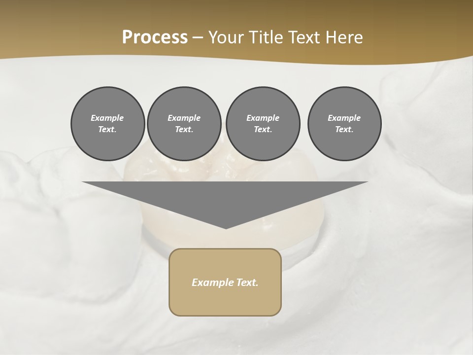 Prosthodontic Gypsum Crown PowerPoint Template
