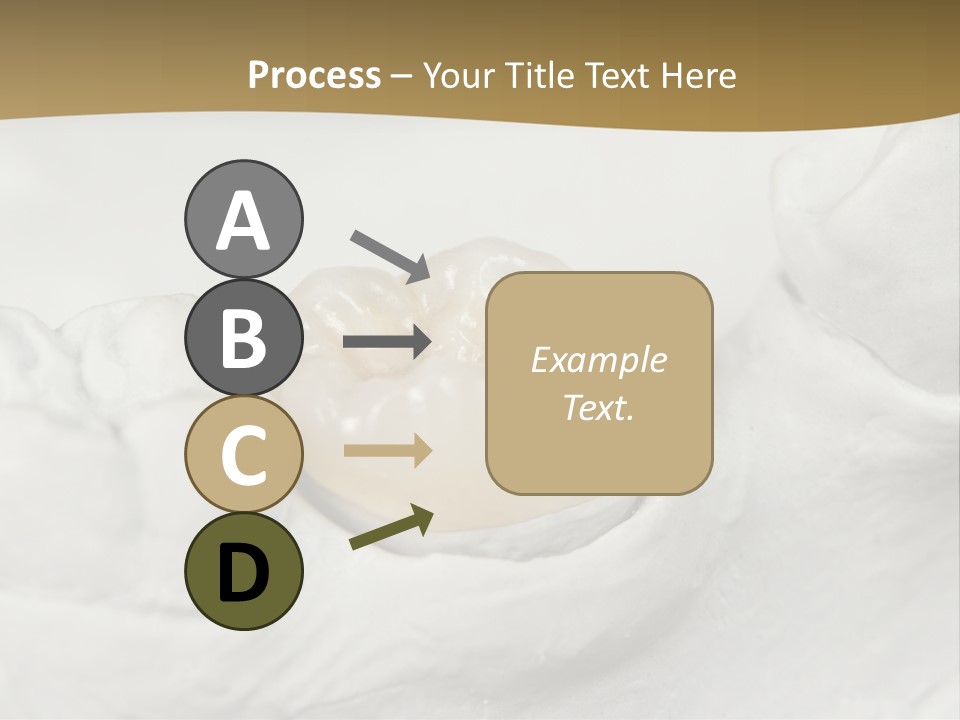 Prosthodontic Gypsum Crown PowerPoint Template