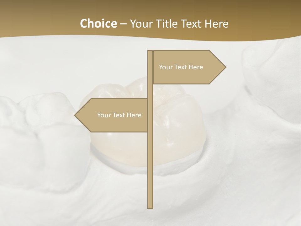 Prosthodontic Gypsum Crown PowerPoint Template