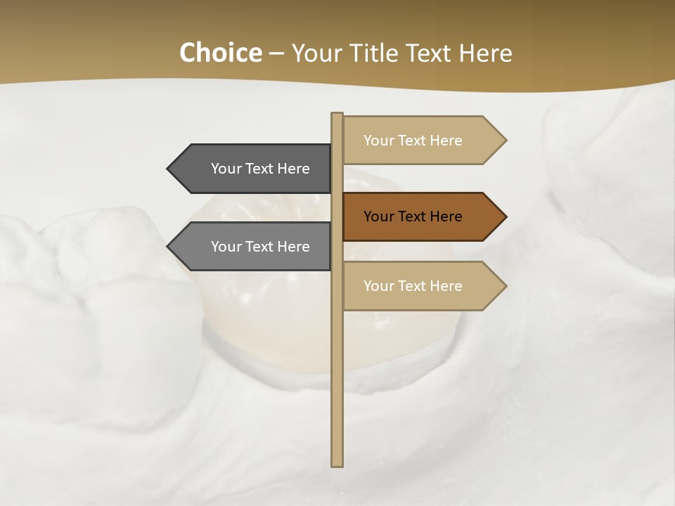 Prosthodontic Gypsum Crown PowerPoint Template