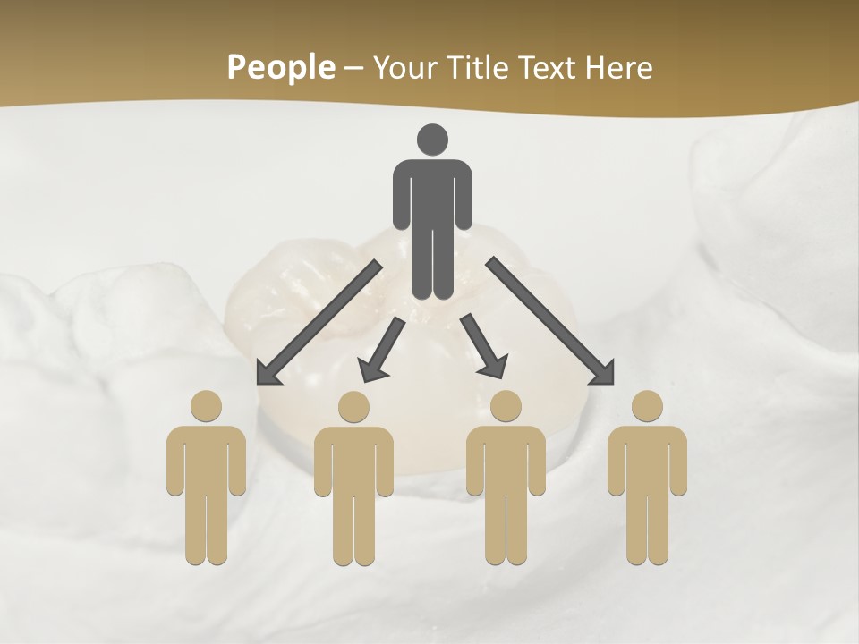 Prosthodontic Gypsum Crown PowerPoint Template