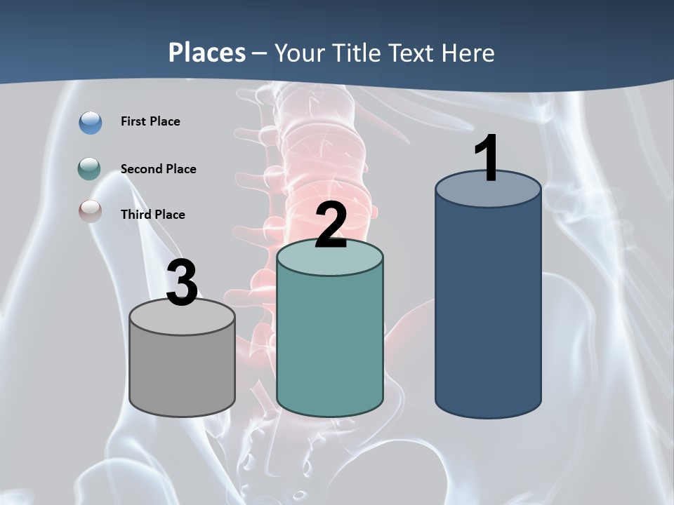 Prolapse Nerve Canal PowerPoint Template