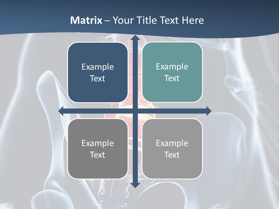 Prolapse Nerve Canal PowerPoint Template