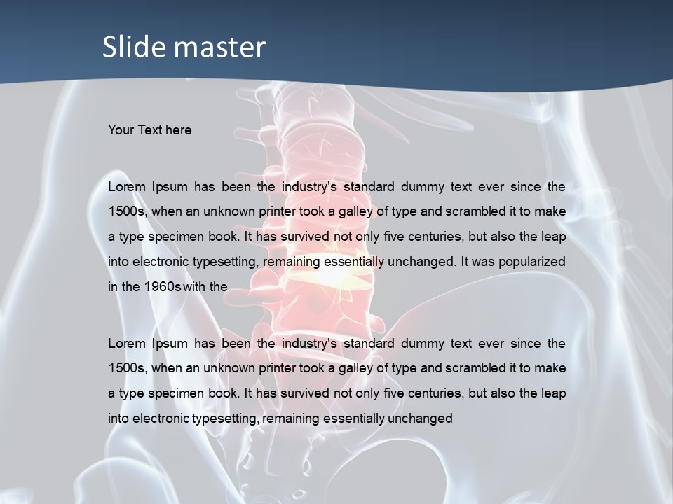 Prolapse Nerve Canal PowerPoint Template