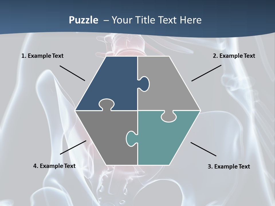 Prolapse Nerve Canal PowerPoint Template