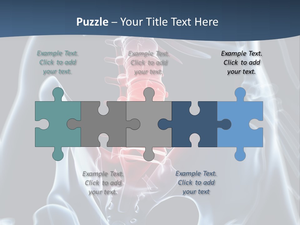 Prolapse Nerve Canal PowerPoint Template