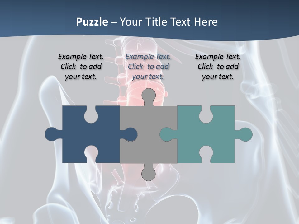 Prolapse Nerve Canal PowerPoint Template