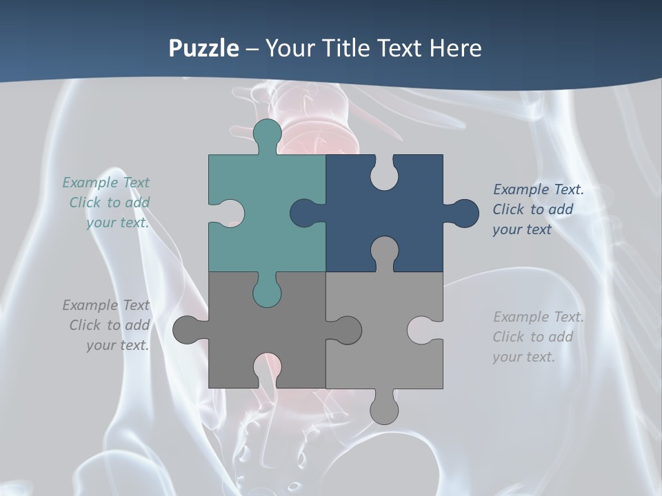 Prolapse Nerve Canal PowerPoint Template