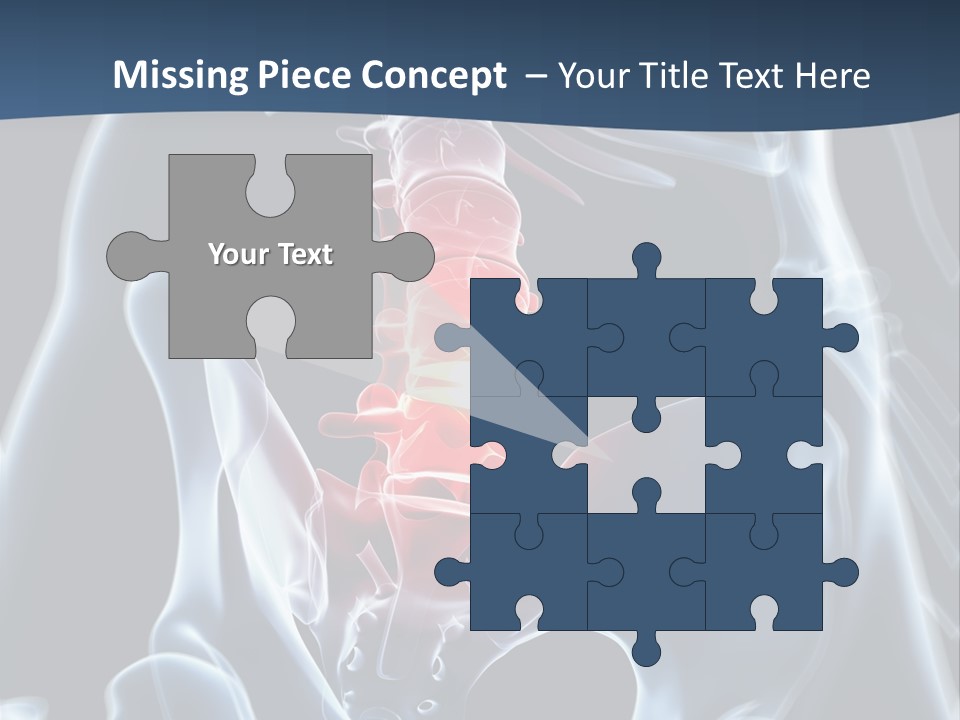 Prolapse Nerve Canal PowerPoint Template