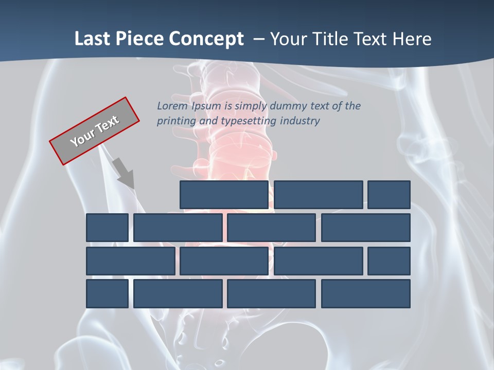 Prolapse Nerve Canal PowerPoint Template