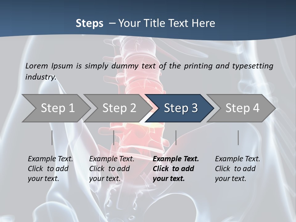 Prolapse Nerve Canal PowerPoint Template