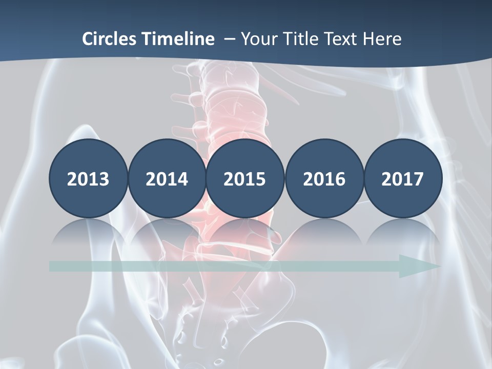 Prolapse Nerve Canal PowerPoint Template